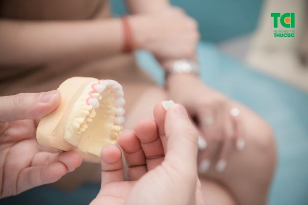 Bọc răng sứ thường chỉ phù hợp với các trường hợp răng lệch ít